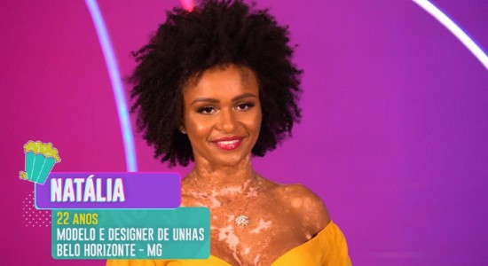 O que é vitiligo? Entenda a doença de Natália Deodato, participante do BBB 22