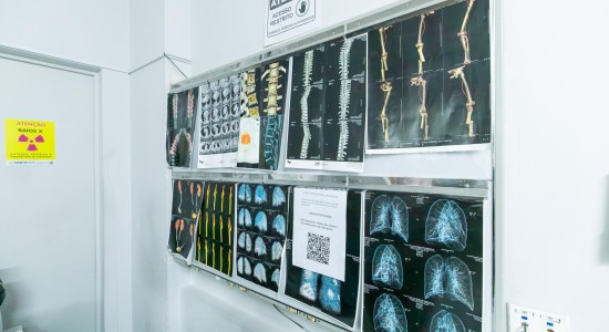 Cuiabá instala ressonância magnética de última geração no São Benedito