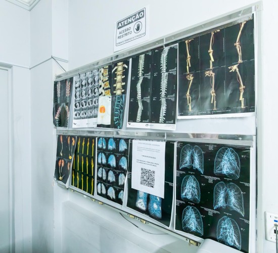 Cuiabá instala ressonância magnética de última geração no São Benedito