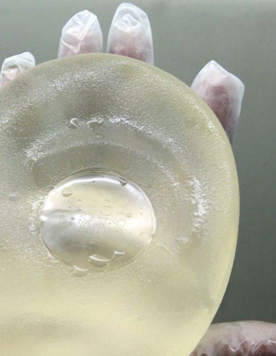 Lei garante troca de implante mamário para paciente de câncer